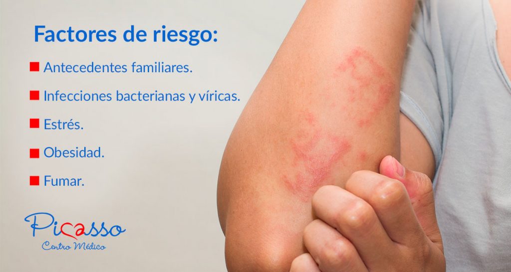 Fejbőr psoriasis español