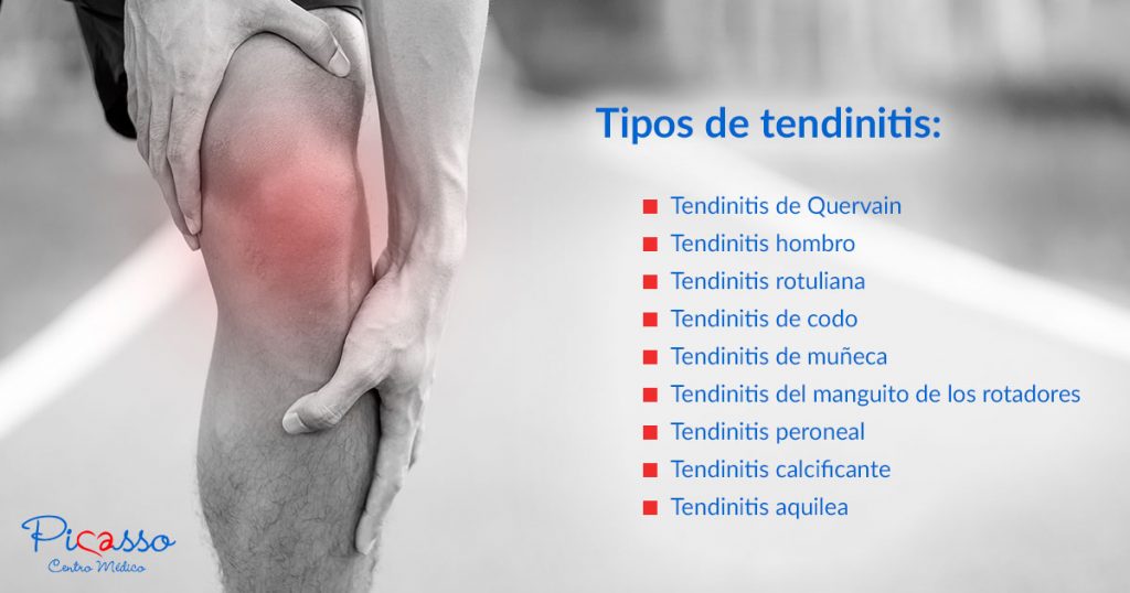 tipos-tendinitis-centro-medico