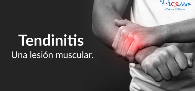 Tendinitis. Una lesión muscular