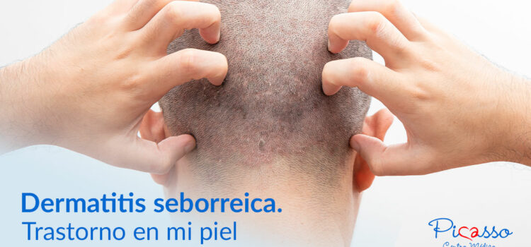 Dermatitis seborreica. Trastorno en mi piel