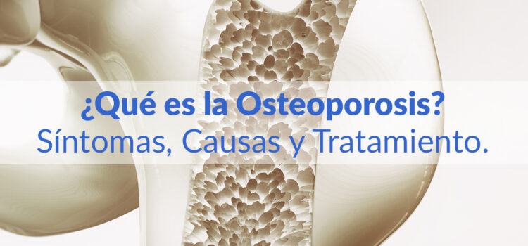 Osteoporosis y su repercusión en la salud