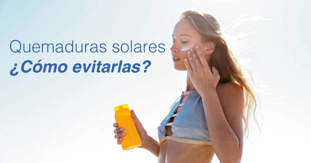 Quemaduras solares